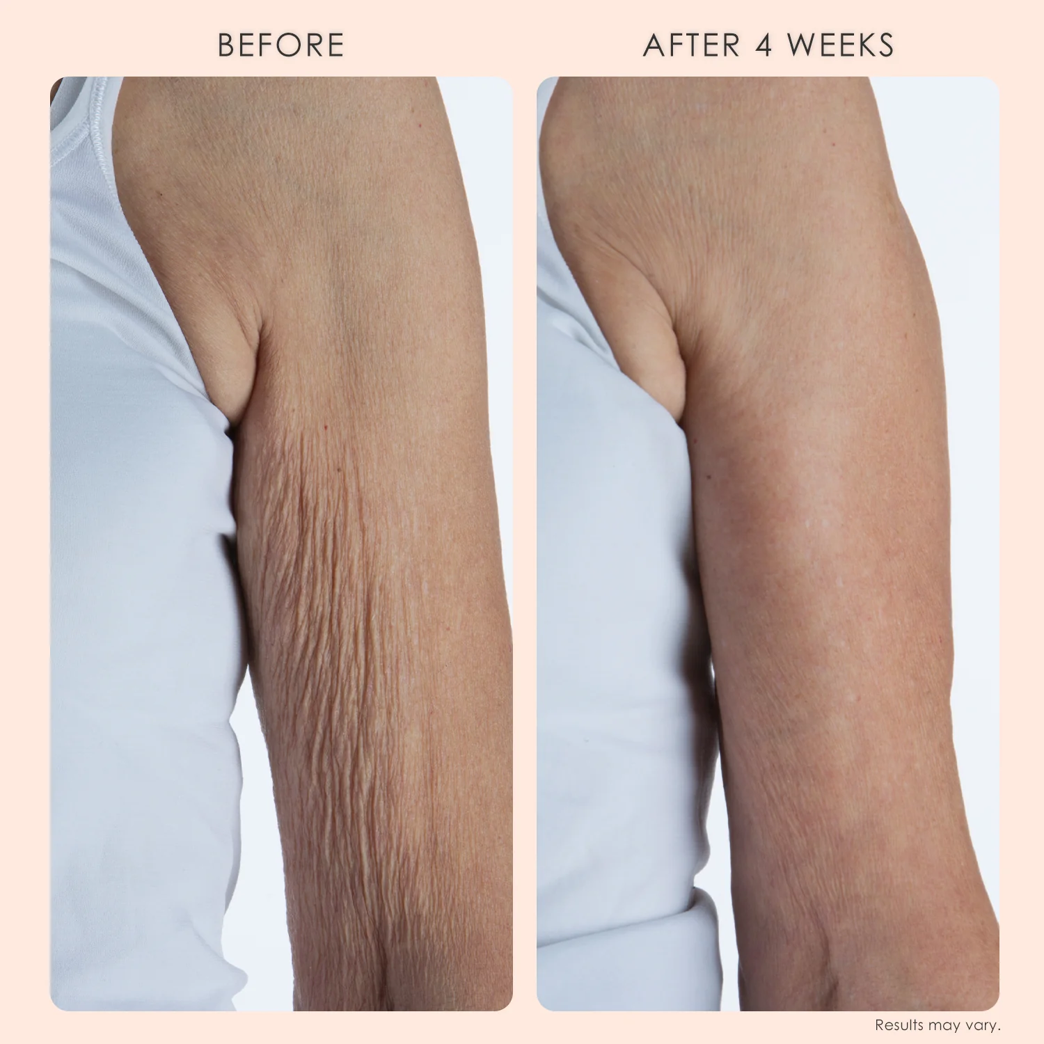 Body Repair Treatment - Image 5