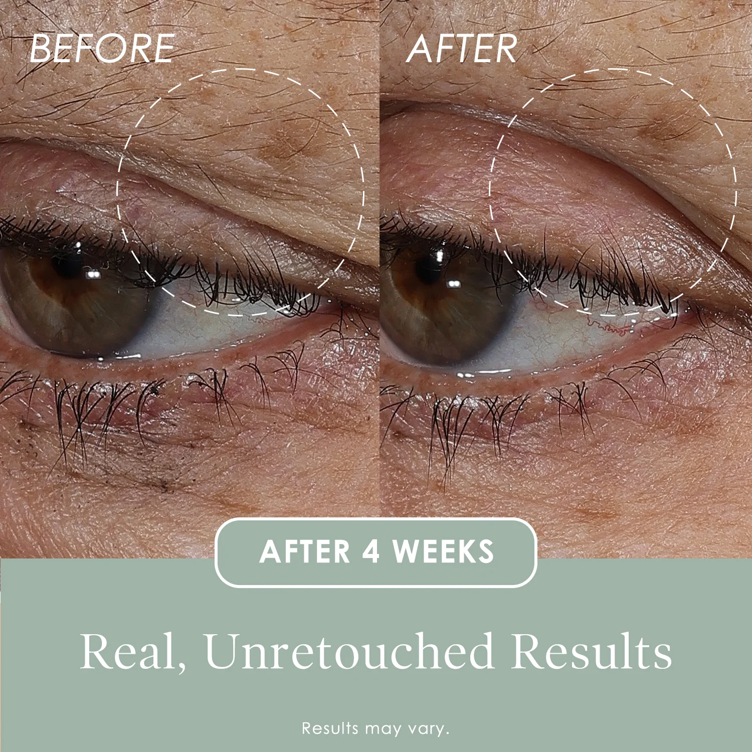 Lift & Smooth Eyelid Treatment - Image 6